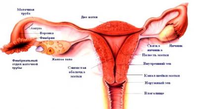 Hidrosálpinx: ¿qué es?